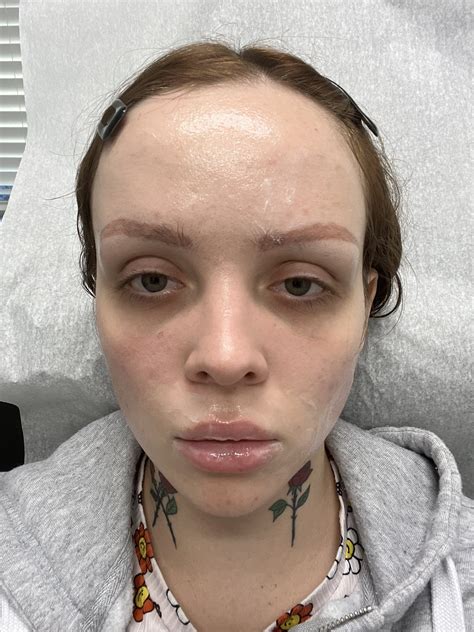 Aliya Brynn On Twitter I Dont Need Makeup Or Filters Just Botox