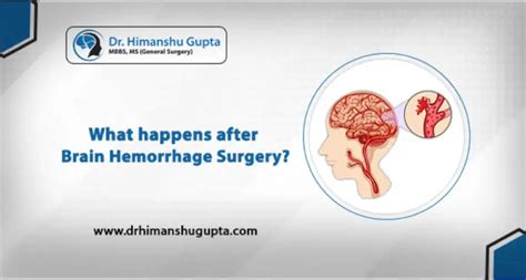 What Happens After Brain Hemorrhage Surgery In 2022 Dr Himanshu Gupta