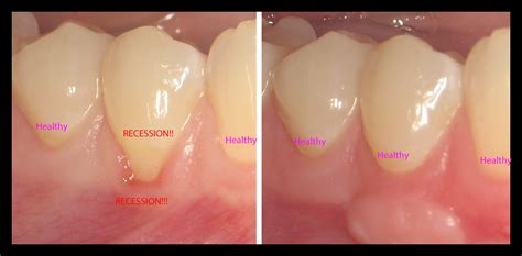 Healthy Gums For A Healthy Life In Tampa Fl Dr Brian Van Aelst