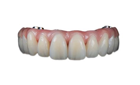 Implant Dentures Ns Denture Clinics