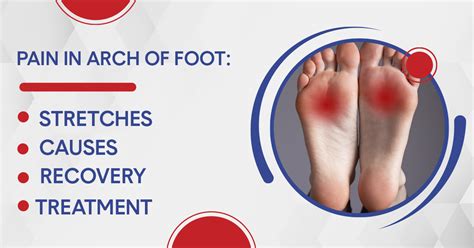 Pain In Arch Of Foot Causes Stretches Treatment And Recovery Vlr Eng Br