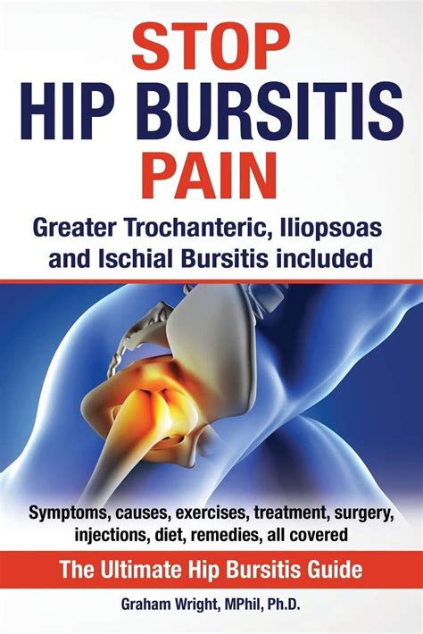 9 Best Exercises For Hip Bursitis Video Included Artofit