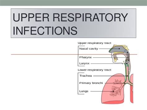 Upper Respiratory Tract Infection Zhongwen Human Body Anatomy