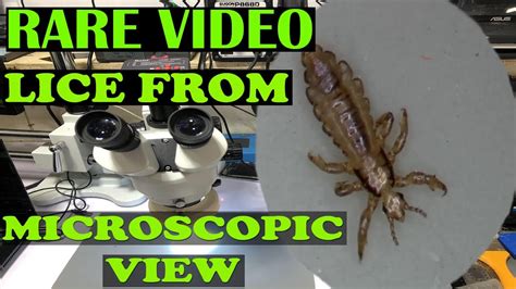 Rare Video Lice From Microscopic View Youtube