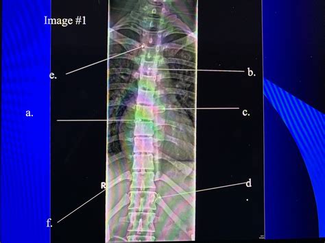Ap Thoracic Spine Diagram Quizlet