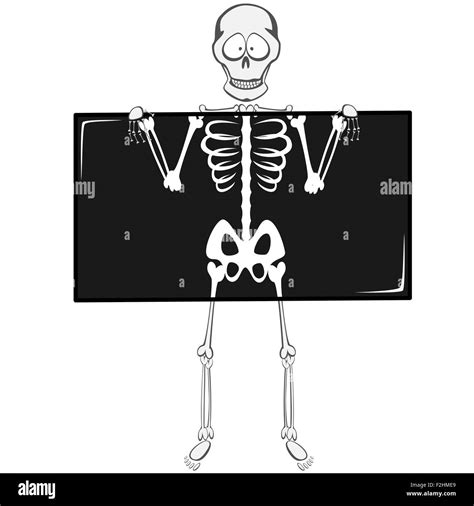 X Ray Skeleton Cartoon