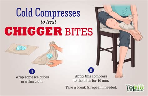 How to prevent chiggers bites and chiggers? How to Treat Chigger Bites | Top 10 Home Remedies