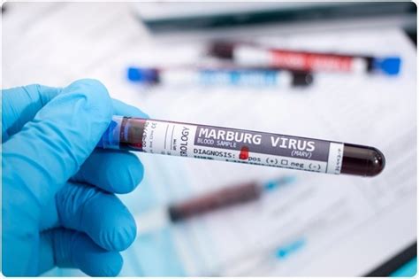 El virus marburgo tiene una taza altamente mortal y a la fecha no existe un tratamiento eficas para combatirlo. ¡Cuidado con la Fiebre Hemorrágica!