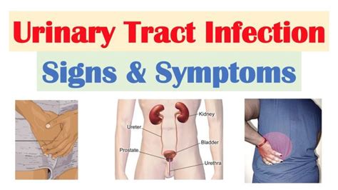 Urine Infection Types Causes Symptoms And Prevention