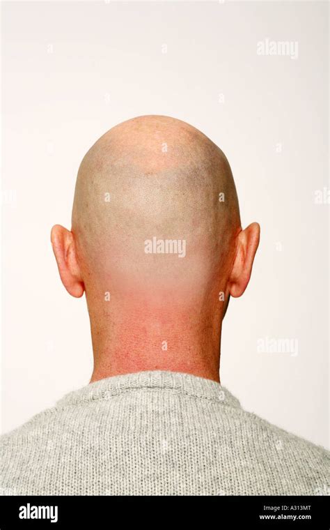 Bald Shiny Head Hi Res Stock Photography And Images Alamy