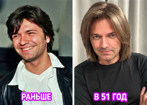 Маликов до и после пластики Инна Маликова похвасталась изменением своей внешности