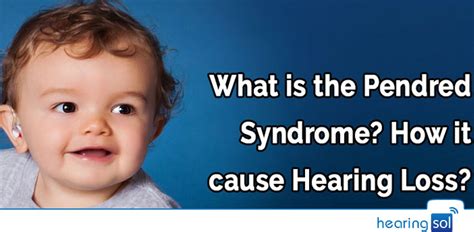 What Is The Pendred Syndrome How It Cause Hearing Loss