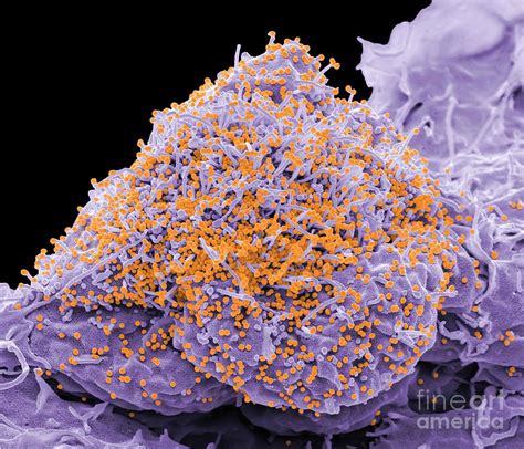 Hiv Infected Cell Photograph By Steve Gschmeissnerscience Photo Library