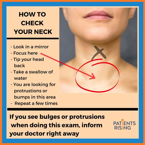 How To Get My Thyroid Checked