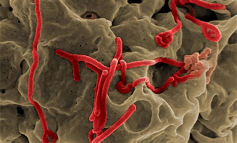 Marburg virus causes marburg hemorrhagic fever — an illness marked by severe bleeding (hemorrhage), organ failure and, in many cases, death. Factsheet about Ebola and Marburg virus diseases