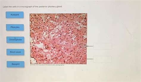 Solved Label The Cells In A Micrograph Of The Posterior Chegg