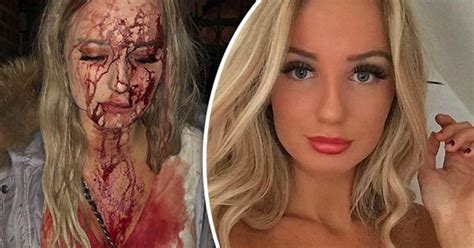 Bloodied Blonde Teen Punched And Bottled In Nightclub For Rejecting