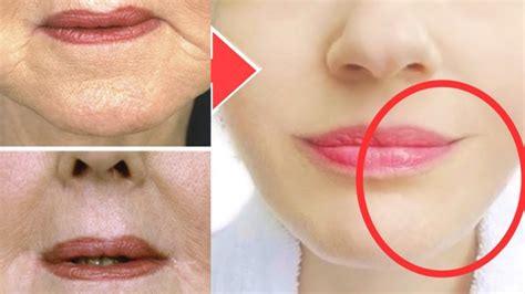 Anti Aging Face Exercise To Lift Lip Corners Fix Droopy Mouth Corners