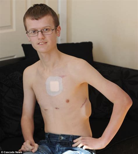 Start studying pacemakers & icds. 'It's like being kicked by a horse': Teenager has ...