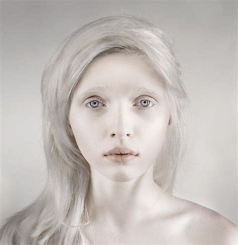 Nastya Kumarova An Albino Girl From Russia Albino Model Albino Girl