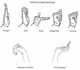 Images of Carpal Tunnel Exercises