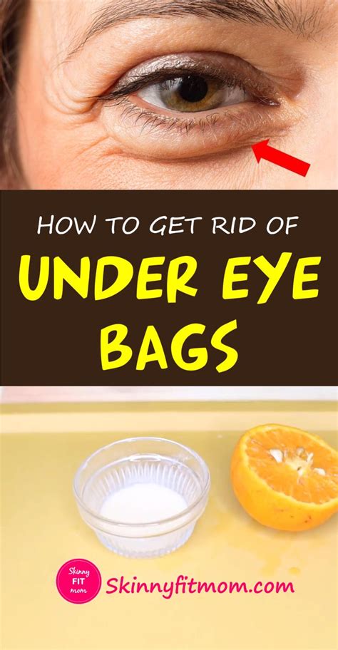 Diy Ways To Get Rid Of Under Eye Bags At Home Video Eye Bags