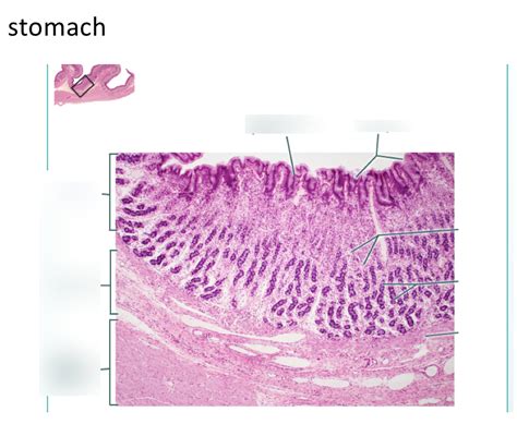 Stomach Histology Stomach Labels Histology Slide Medi