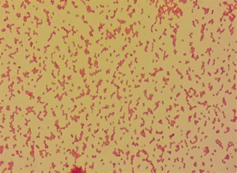 Gram Stain From Anaerobic Culture Plate Showing Small Gram Negative