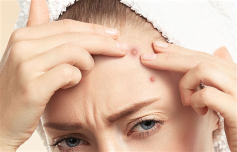 What Do Pimples On The Forehead Mean Glam Skin Review