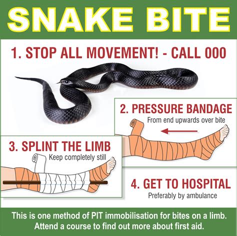 First Aid Given For Snake Bite Snake Poin