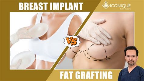 Fat Grafting Vs Breast Implants For Breast Augmentation Best Breast