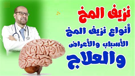 حلقة شاملة🧠 عن نزيف المخ دكتور جودة محمد عواد🧠 youtube
