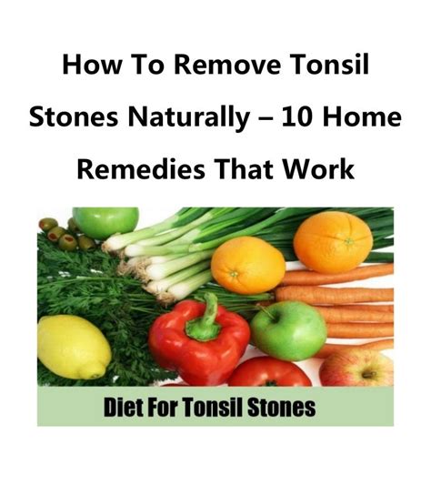 How To Remove Tonsil Stones Naturally 10 Home Remedies That Work