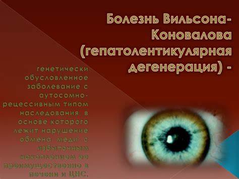 Болезнь Вильсона-Коновалова (гепатолентикулярная дегенерация Картинка - Болезнь Вильсона-Коновалова (гепатолентикулярная дегенерация