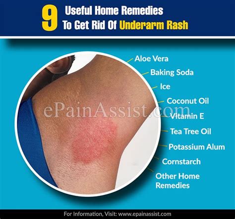 9 Useful Home Remedies To Get Rid Of Underarm Rash Underarm Rash