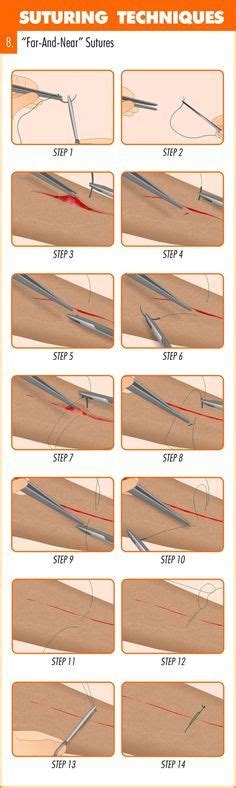 Complete Guide To Mastering Suturing Techniques Medical Education