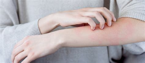 Skin Rashes And Cardiovascular Disease Is There A Link Dr Doug Pucci