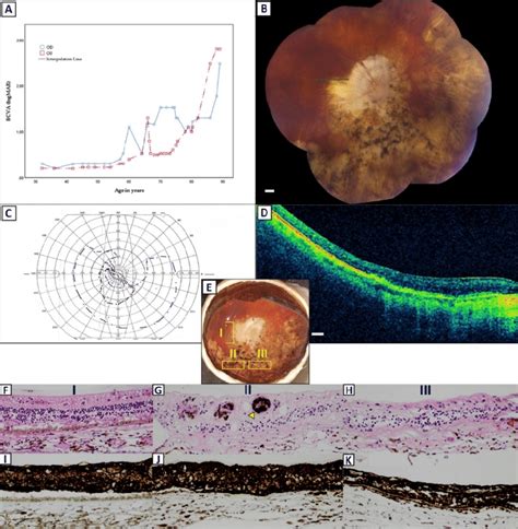 Clinical Characteristics And Postmortem Histopathological Examination