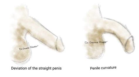 Curved Penis Telegraph