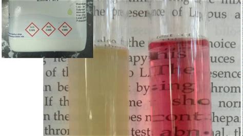 Salt Tolerance Test Stt For Confirmation Of Enterococci Species Youtube