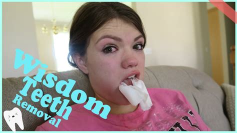 Wisdom Teeth Removal Funny Reaction Youtube