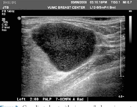 Figure 2 From The Sonographic Findings And Differing Clinical