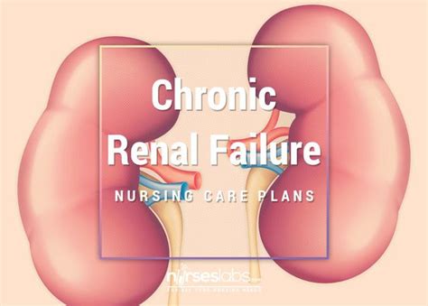 Chronic Renal Failure Nursing Care Plans Nurseslabs Nursing Study Guide Nursing Care Plan