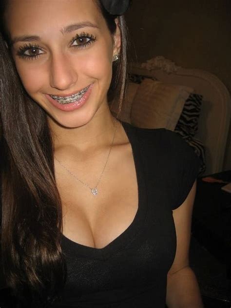Pin On Girls With Braces D
