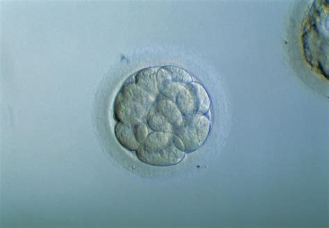 Morula Embryo Photograph By Pascal Goetgheluckscience Photo Library