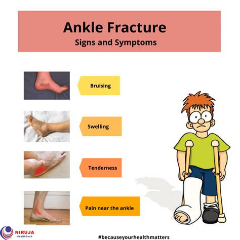 Ankle Fracture Ankle Fracture Types Of Fractures Bone And Joint
