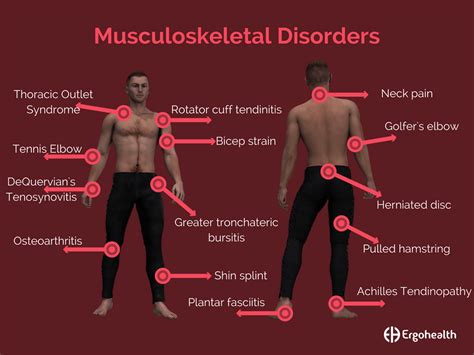 Skeletal Muscular System Disease Disorder Project By