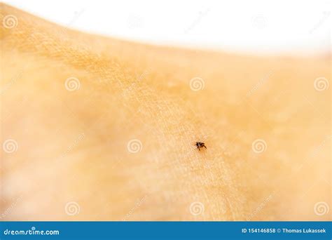 Tick On Human Skin Carrier Of Infections Of Encephalitis Parasite