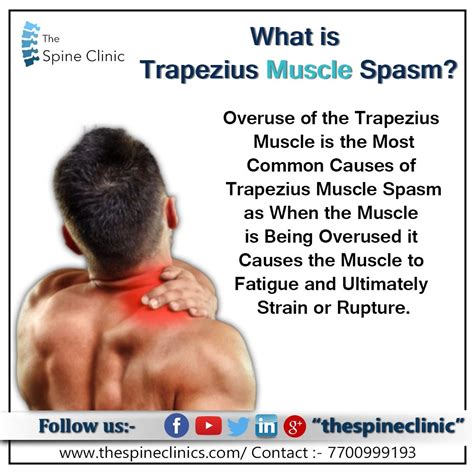 What Is Trapezius Muscle Spasm What Is Trapezius Muscle Spasm By The
