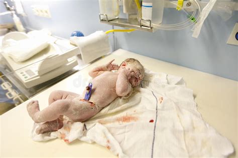 Comment Vivre Après Un Accouchement Sous X - Vernix A Couvert Nouveau-né Dans La Salle D'accouchement Photo stock
